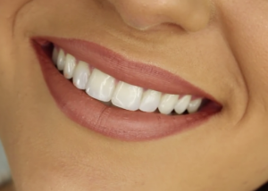 Healthy_Smiling_Teeth